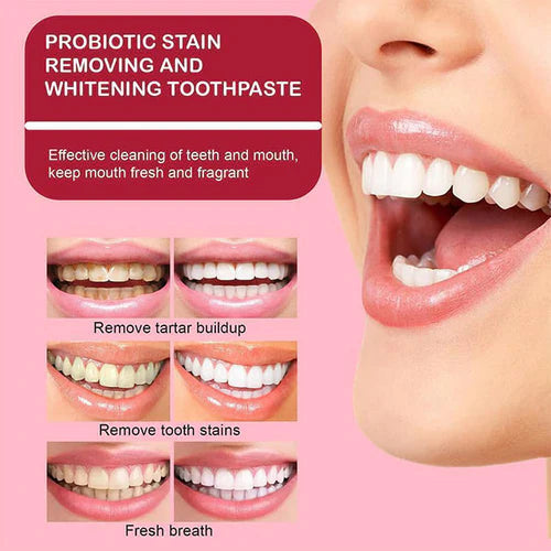 🔥HOT SALE🔥SP-6 Whitening Toothpaste丨Powerful Oral Health & Disease Treatment